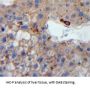 Low Density Lipoprotein Receptor (LDLR) Antibody
