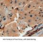 Serum Amyloid A-2 Protein (SAA2) Antibody