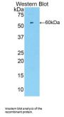 Cyclin Dependent Kinase 2 (CDK2) Antibody