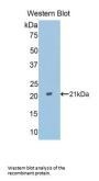 Peroxisome Proliferator Activated Receptor Delta (PPARd) Antibody