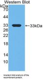 E1A Binding Protein P300 (EP300) Antibody