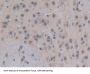 E1A Binding Protein P300 (EP300) Antibody