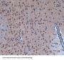 E1A Binding Protein P300 (EP300) Antibody