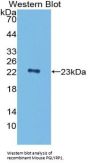 Peptidoglycan Recognition Protein 1 (PGLYRP1) Antibody
