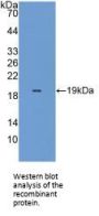Peroxiredoxin 5 (PRDX5) Antibody