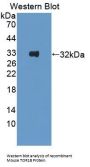 Torsin 1B (TOR1B) Antibody