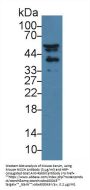 Nischarin (NISCH) Antibody
