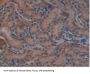 Glutamate Dehydrogenase 1 (GLUD1) Antibody
