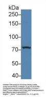 Serine/Threonine-Protein Kinase D2 (PRKD2) Antibody