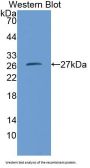 Serine/Threonine-Protein Kinase D2 (PRKD2) Antibody