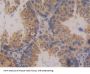 Serine/Threonine-Protein Kinase D2 (PRKD2) Antibody