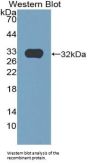 Epidermal Growth Factor (EGF) Antibody
