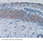 Interleukin 1 Delta (FIL1d) Antibody