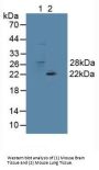 Glutathione S Transferase Theta 1 (GSTt1) Antibody