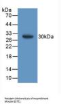 Glutathione S Transferase Theta 1 (GSTt1) Antibody