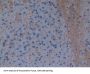 Glutathione S Transferase Theta 1 (GSTt1) Antibody