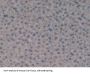 Glutathione S Transferase Theta 1 (GSTt1) Antibody