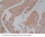 Glutathione S Transferase Theta 1 (GSTt1) Antibody