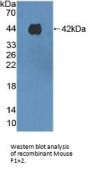 Prothrombin Fragment 1+2 (F1+2) Antibody