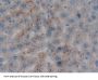 Prothrombin Fragment 1+2 (F1+2) Antibody