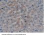 Prothrombin Fragment 1+2 (F1+2) Antibody