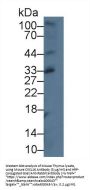 C-X-C Motif Chemokine 16 (CXCL16) Antibody