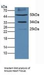 Programmed Cell Death 1 Ligand 1 (CD274) Antibody