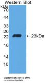 T-Cell Differentiation Antigen CD6 (CD6) Antibody