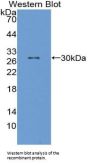 Protein Tyrosine Phosphatase Receptor Type H (PTPRH) Antibody
