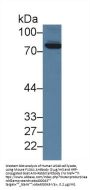 Coagulation Factor XIII A1 Polypeptide (F13A1) Antibody