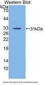 Coagulation Factor XIII A1 Polypeptide (F13A1) Antibody