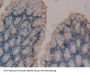 Coagulation Factor XIII A1 Polypeptide (F13A1) Antibody