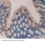 Coagulation Factor XIII A1 Polypeptide (F13A1) Antibody