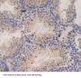 Sperm Specific Antigen 2 (SSFA2) Antibody