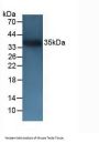Cluster Of Differentiation 72 Antibody