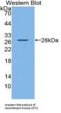 Cluster Of Differentiation 72 Antibody