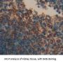 Cluster Of Differentiation 72 Antibody