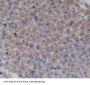 V-Fos FBJ Murine Osteosarcoma Viral Oncogene Homolog (FOS) Antibody