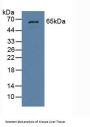 Glucokinase Regulatory Protein (GKRP) Antibody