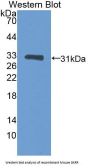 Glucokinase Regulatory Protein (GKRP) Antibody