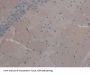 Fibroblast Growth Factor 2, Basic Antibody