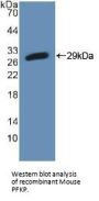 Phosphofructokinase, Platelet (PFKP) Antibody