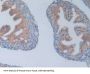 Phosphofructokinase, Platelet (PFKP) Antibody