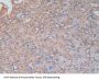 Phosphofructokinase, Platelet (PFKP) Antibody