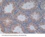 Phosphofructokinase, Platelet (PFKP) Antibody
