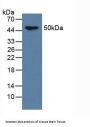 Microtubule-Associated Protein Tau (MAPT) Antibody