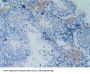 Microtubule-Associated Protein Tau (MAPT) Antibody