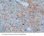 Microtubule-Associated Protein Tau (MAPT) Antibody