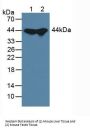 Adenosine Kinase (ADK) Antibody