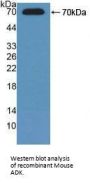 Adenosine Kinase (ADK) Antibody